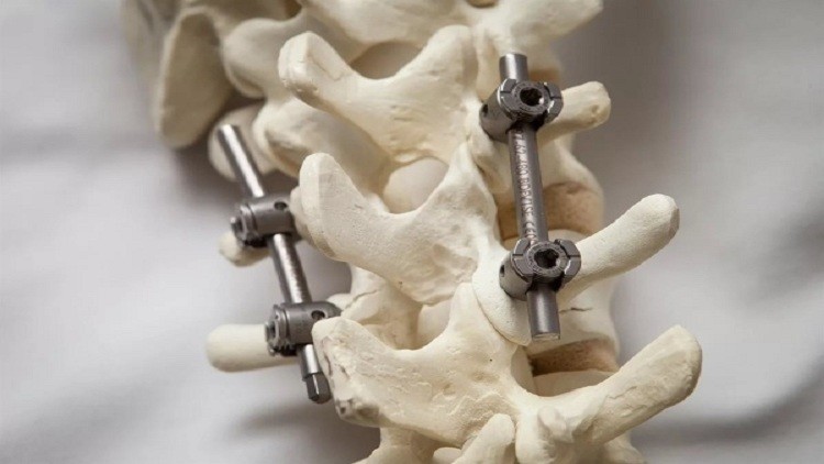 علماء يطورون بديلاً للعظام البشرية ! Image