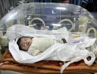 صحة غزة: استشهاد 4 أطفال نتيجة الجفاف وسوء التغذية