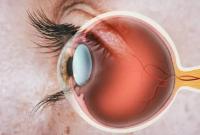 دراسة: شبكية العين تتنبأ بالنوبة القلبية 