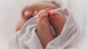  ولادة طفلة بقلب خارج القفص الصدري - صورة